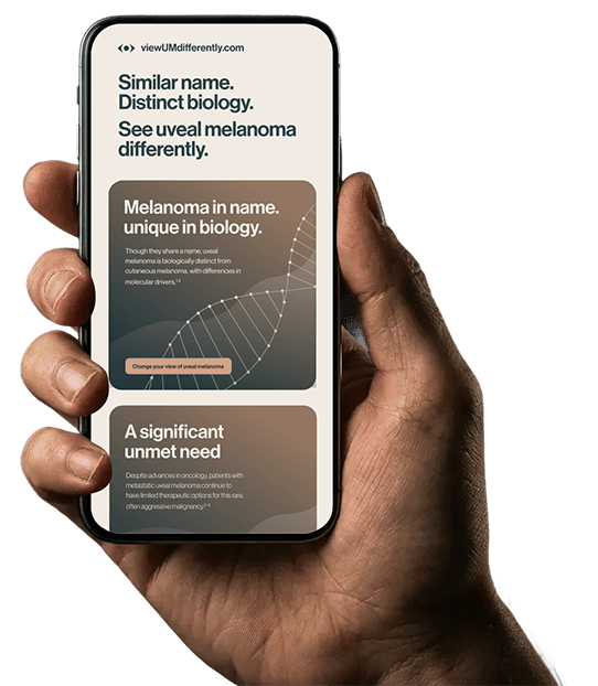 Hand holding a smartphone displaying information about metastatic uveal melanoma advances